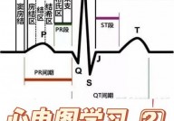 心电数据库,心电数据库的重要性与概述